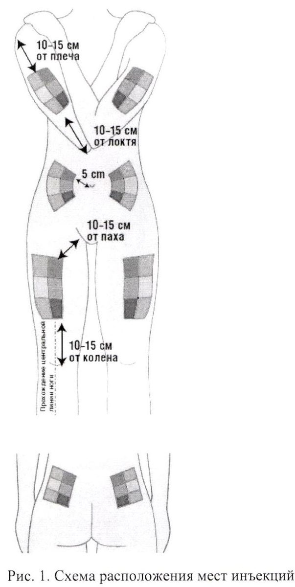 Можно колоть уколы в ногу. Схема внутримышечной инъекции в бедро. Внутримышечный укол в мышцу ноги схема. Схема введения внутримышечной инъекции в бедро. Правильно поставить укол внутримышечно в бедро.