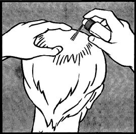 Сыворотка алерана от выпадения волос инструкция по применению