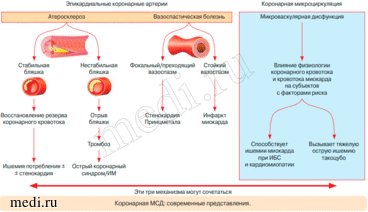 Реферат: Синдром кардиалгии при различных формах ИБС